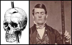 Left: Depiction of his damaged skull by his doctor John Harlow (1868). Right: Excerpt from a recently discovered photograph of Phineas and his tamping iron (see here for a note on the source and copyright).